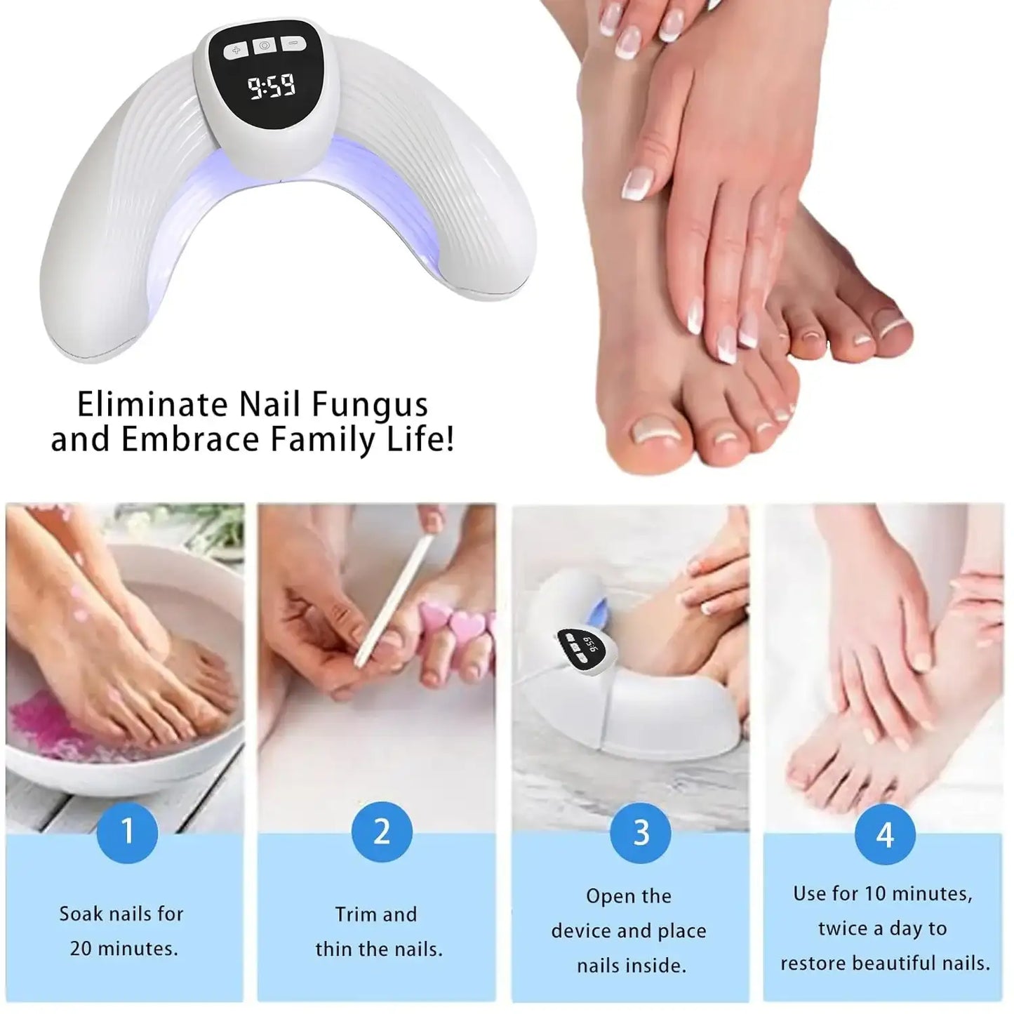 MycoBeam Nail Fungus Laser – Home Use