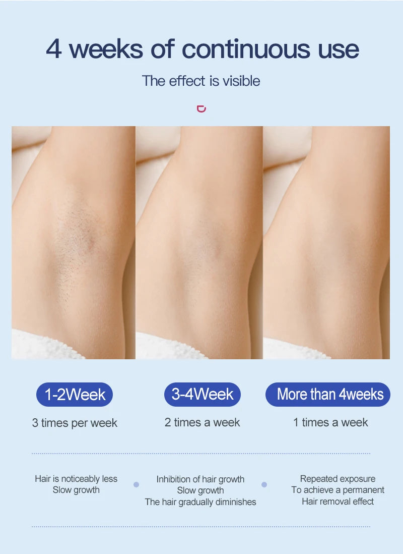 LumiSilk Ice Pro – IPL Hair Removal Device