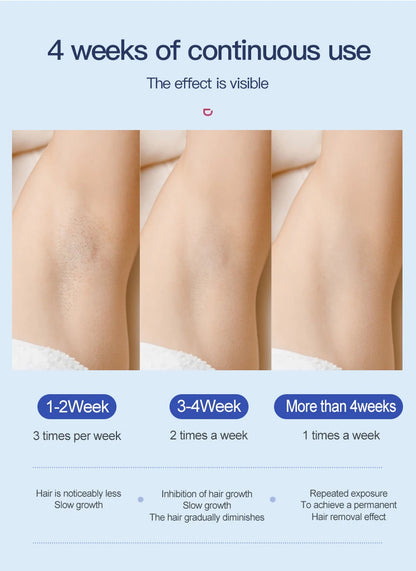 LumiSilk Ice Pro – IPL Hair Removal Device