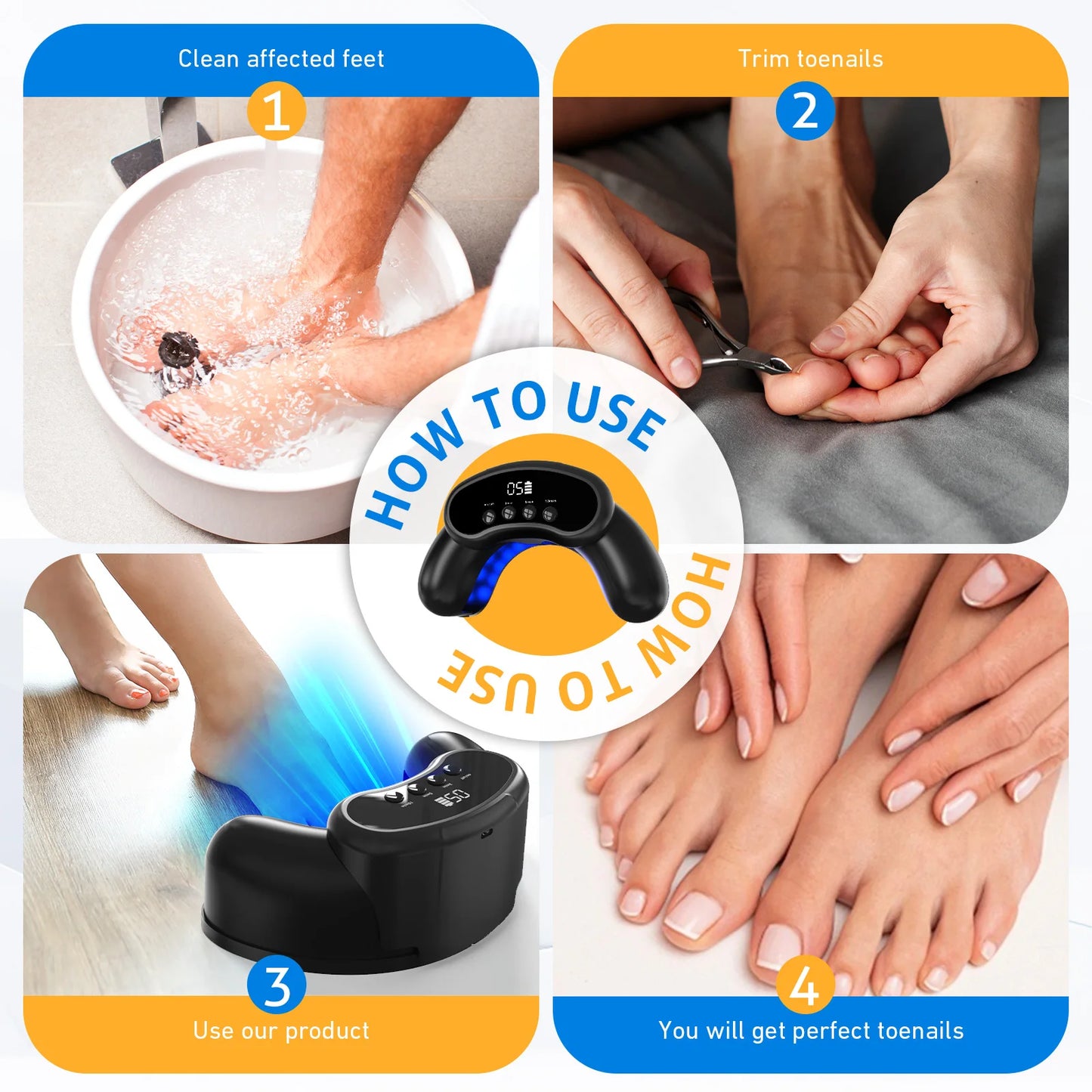 MycoBeam Wireless Nail Laser – Dual 470/905 nm