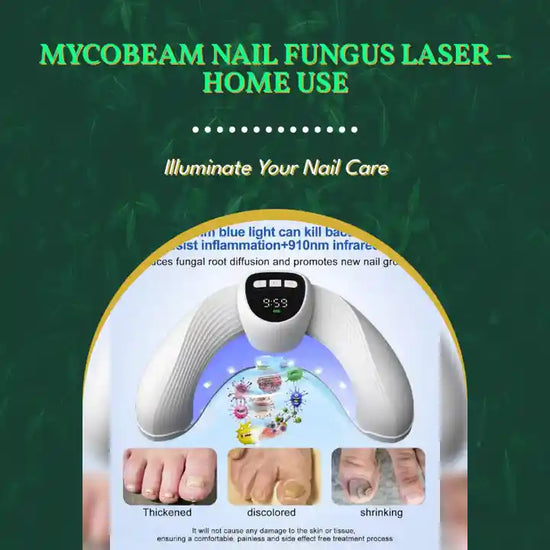 MycoBeam Nail Fungus Laser &ndash; Home Use by@Outfy