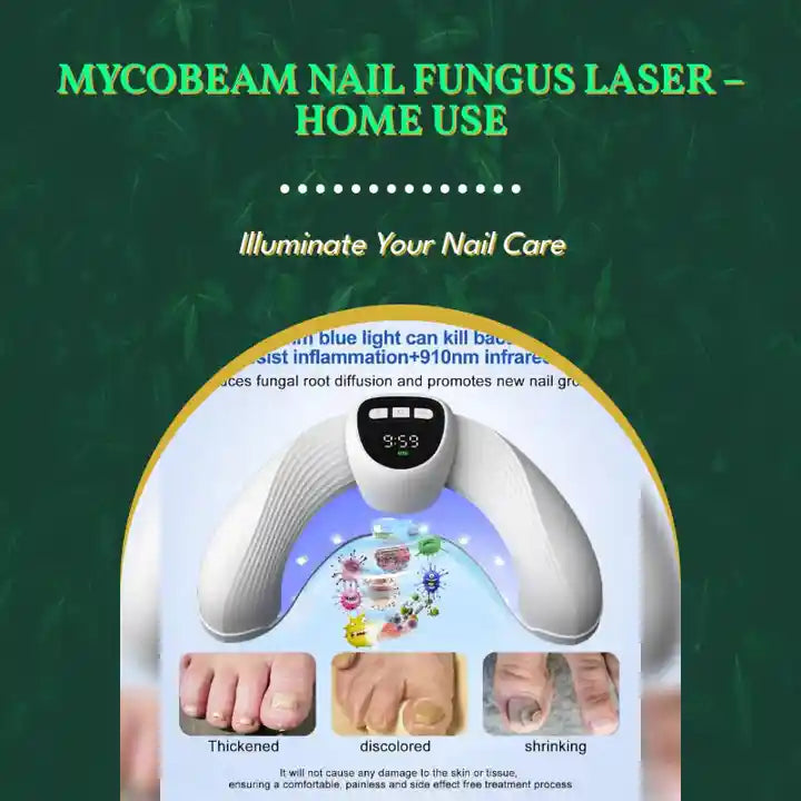 MycoBeam Nail Fungus Laser &ndash; Home Use by@Outfy
