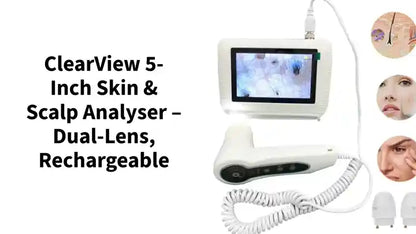 ClearView 5-Inch Skin &amp; Scalp Analyser &ndash; Dual-Lens, Rechargeable by@Outfy